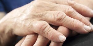¿Bajo qué patologías duelen las articulaciones de los dedos 
