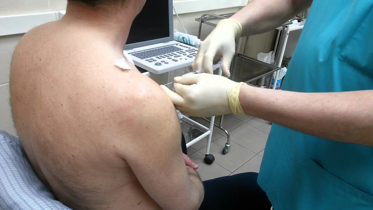 inyección en el hombro con artrosis